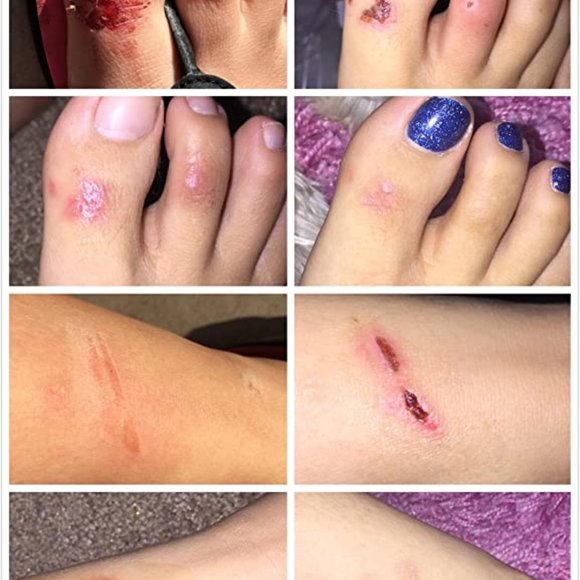 Bio Oil - Picture 8 of 10